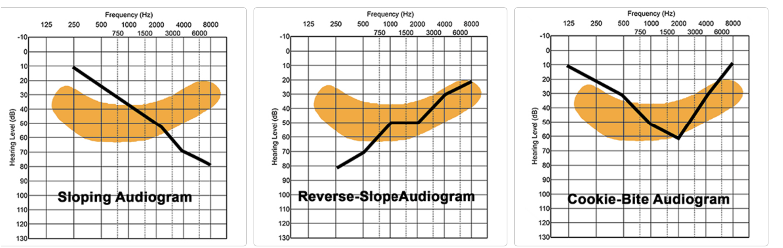 Understanding Hearing Loss - Ear Buddy Hearing